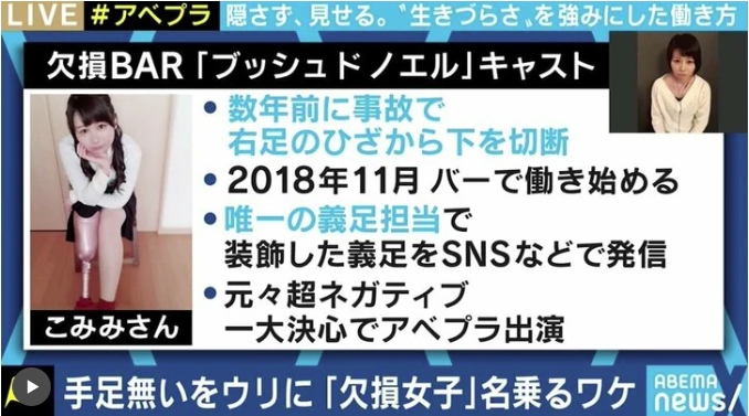 義足アイドルのこみみ